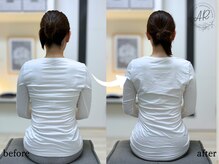 エーアール(AR)/【Before/After】