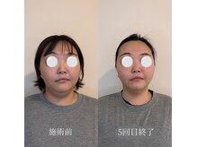 リスタット 市原(Restat)の雰囲気（【小顔矯正】エラ張りを改善しスッキリした理想の小顔へ）