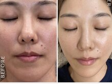 リノ(Lino)の雰囲気（くすみ・毛穴・乾燥やたるみもハリや透明感を取り戻します♪）