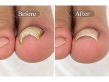 ミムネイル(mim nail)の雰囲気（【巻き爪でお悩みの方】巻き爪でお悩みの方ご相談ください！）