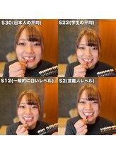 ホワイトサロン/歯の色比較画像１☆彡