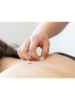 鍼灸施術を受けたい