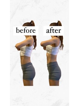 ビーアイリー(Be irie)/痩身エステ直後の変化