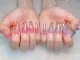 チップスカルプ