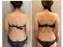 TMサロン 赤坂/メリハリボディに！