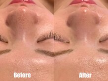 ベレッツァ 恵比寿(BELLEZA)の雰囲気（本気の肌質改善/毛穴改善コース）