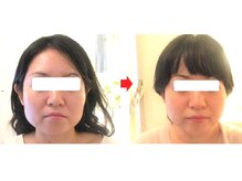 サロンドエステケイワイ(de KY)/フェイシャル☆小顔、タルミ改善