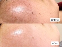 至空院/ハーブトリートメント