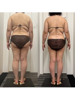 テラピ 藤江店/マイナス5キロで見た目大幅痩せ!