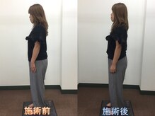 心笑整体院/施術