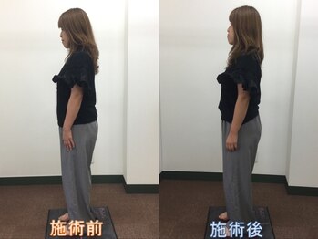 心笑整体院/施術