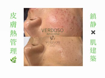 クレセント(crescent)