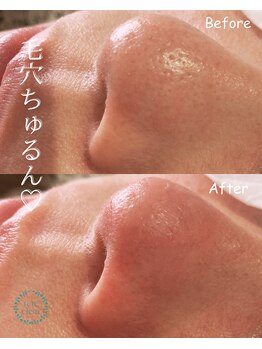 モエラビューティーサロン(Moela beauty salon)/【全顔毛穴洗浄】