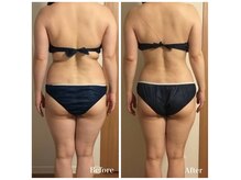 ブーティサロン(BOOTY SALON)の雰囲気（痩身エステ最高峰機器【ハイパーナイフ】導入店舗）