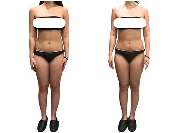 アイル(Isle)/2ヶ月集中ブライダルコース