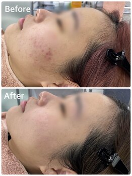 スハダビ110(suhadabi110)/before after