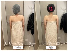 リノ(Lino)/ブライダルエステでご来店♪