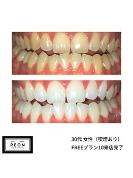 レオン 磐田(REON)/◇ お客様 before＆after ◇
