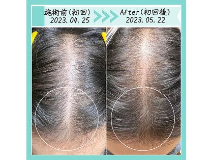 レマンドゥースの写真