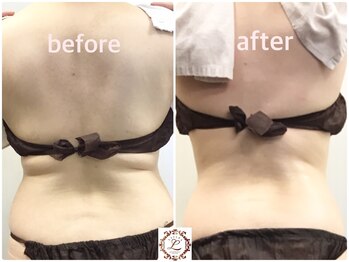 ラウレア 西条店(LAULEA)/脂肪燃焼効果！たった10分の奇跡