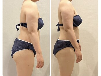 サロンサンティ/バザルトボディトリートメント