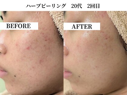 サンビ(SANBI)の写真