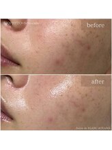 サロン ド ブラン アオヤマ(Salon de BLANC AOYAMA)/