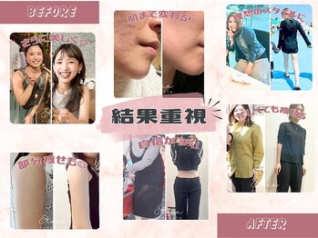 ヨサパーク エトワ 湖東(YOSA PARK Etoia)