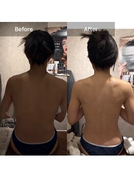 ルネアススパ 南青山(Lune’as Spa)/《WINBACK》背中