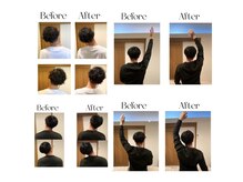 ヴィボーン(Vibone)/１度の施術で効果を実感！