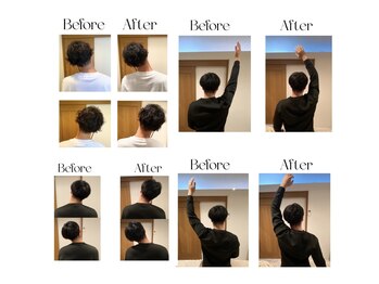 ヴィボーン(Vibone)/1度の施術で効果を実感!