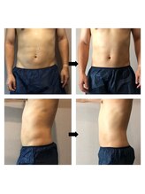 伊達男/フォースカッター事例