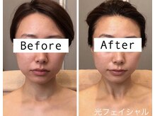 ムーンライズ(moonrise)/