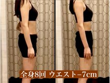 サロン セドナ(SALON SEDONA)/全身リンパ痩身 8回コース