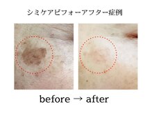 カピリナスパ(Ka.Pilina Spa)/before⇒after