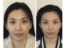 本格整体院 日本橋の雰囲気（歴26年！施術人数延べ10万人以上！お悩みに合わせた施術で効果◎）