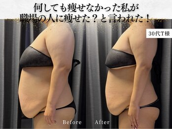 ダイヤモンドトゥルース(Diamond truth)/長年溜め込んだセルライトも解消