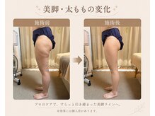 艶の雰囲気（脚のむくみを整え、すらりと美しいラインへ）