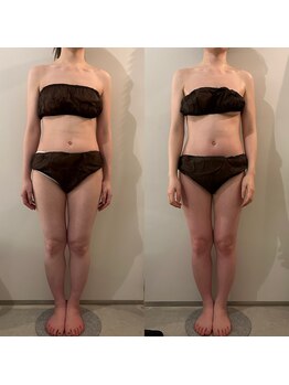 ラナ 京都西院店(Lana)/よもぎ＆全身リンパマッサージ