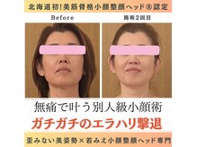 ウエルネスエステサロンジョー(Wellness Este Salon JO)の雰囲気（たるみ緩和エラハリ撃退小顔矯正ヘッド×筋骨格調整）