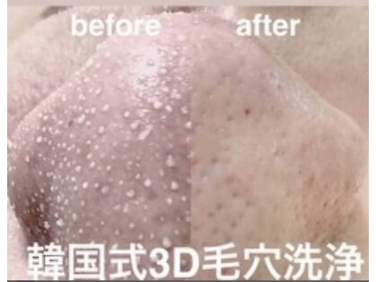メディカルエステ ユウ(Yuu)の写真