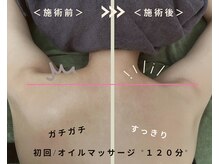 辛い首肩こり慢性的な頭痛もスッキリ改善！一番人気は120分！