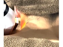 アンスル 那覇(AnSL)/毛穴　脱毛　痩身