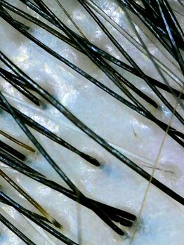 アンジール(ANJIR)/綺麗な頭皮へ