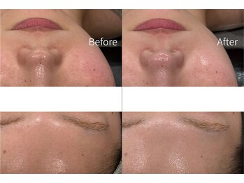 エクラ(eclat)/赤み/鎮静/ツヤ/水光肌