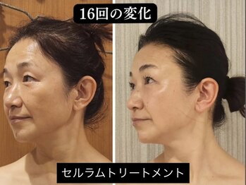 ハナヨサロン(hanayo salon)/大人気♪セルラムトリートメント