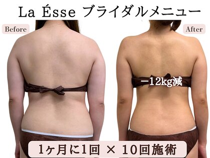 ラエッセ(La Esse)の写真