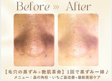 インファイン ハミルトン店(infine)