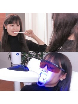 福岡ホワイトニングシロ 天神中洲店(福岡ホワイトニングSHIRO)/【セルフホワイトニング】STEP5