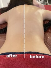 ビューティールーム リヴィア(BEAUTY ROOM RIVIA)/筋膜リリースbefore/after